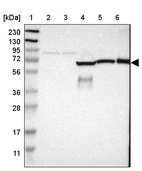 Lane 1: Marker [kDa] 230, 130, 95, 72, 56, 36, 28, 17, 11_br/_Lane 2: Human cell line RT-4_br/_Lane 3: Human cell line U-251MG sp_br/_Lane 4: Human plasma (IgG/HSA depleted)_br/_Lane 5: Human liver tissue_br/_Lane 6: Human tonsil tissue