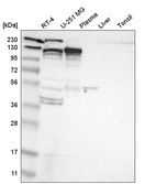 Anti-KIF11 Antibody