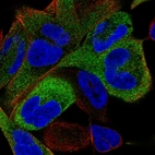 Immunofluorescent staining of human cell line RH-30 shows localization to cytosol.