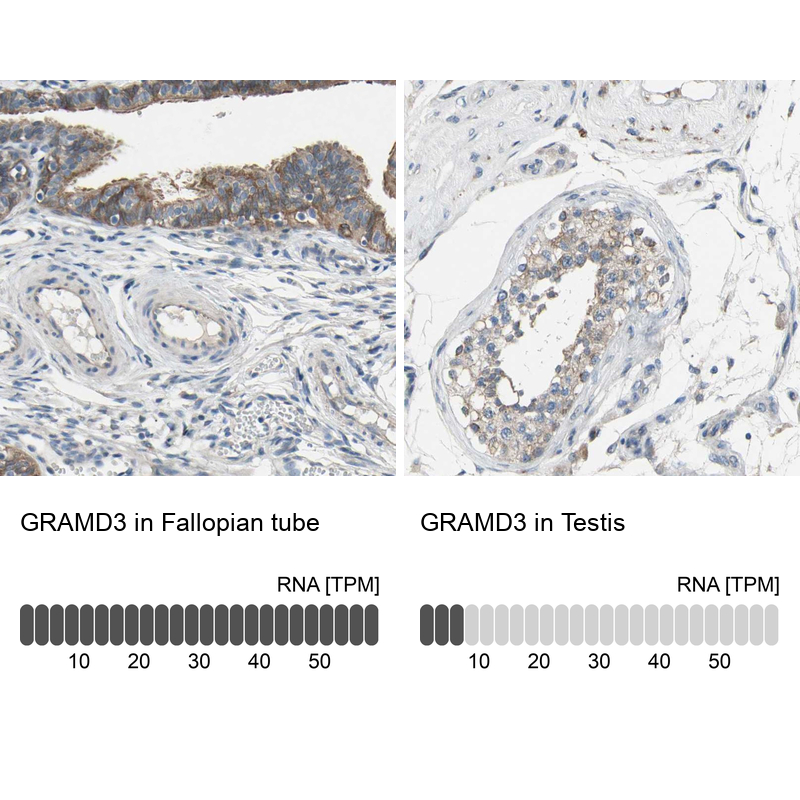 Anti-GRAMD3 Antibody