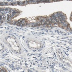 Anti-GRAMD3 Antibody