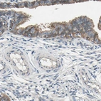 Immunohistochemical staining of human fallopian tube shows high expression.