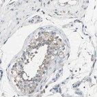 Immunohistochemical staining of human testis shows low expression as expected.