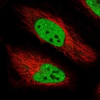 Immunofluorescent staining of human cell line HeLa shows localization to nucleoplasm.