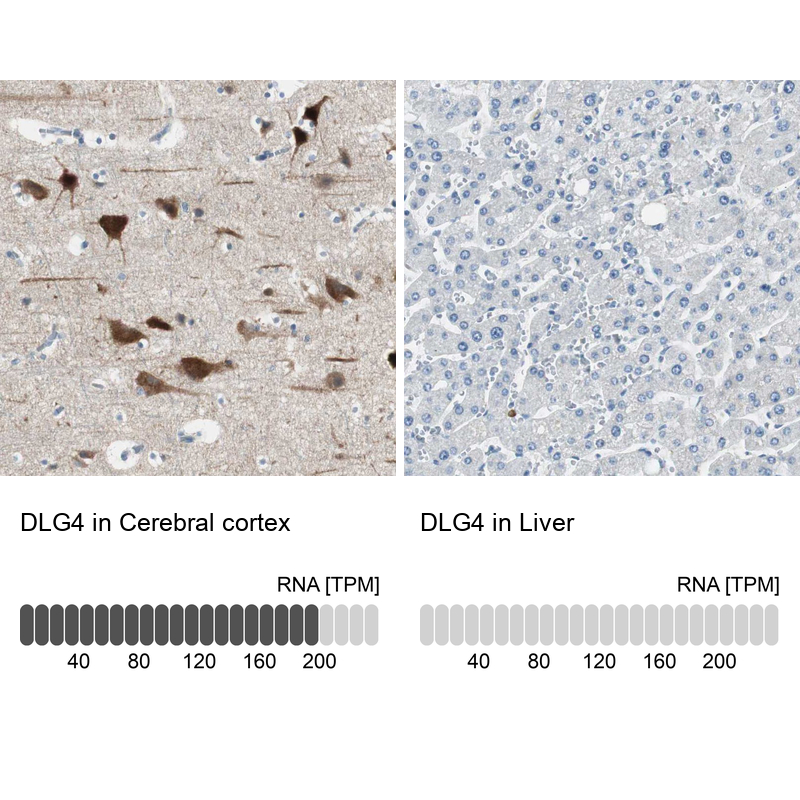 Anti-DLG4 Antibody