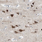 Immunohistochemical staining of human cerebral cortex shows high expression.