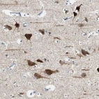 Immunohistochemical staining of human cerebral cortex shows high expression.