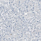 Anti-DLG4 Antibody