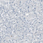 Immunohistochemical staining of human liver shows low expression as expected.