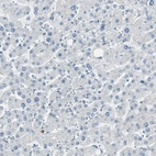 Immunohistochemical staining of human liver shows low expression as expected.