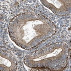 Immunohistochemical staining of human endometrium shows moderate cytoplasmic positivity in glandular cells.