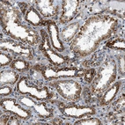 Immunohistochemical staining of human kidney shows moderate cytoplasmic positivity in cells in tubules.