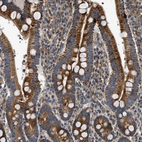 Immunohistochemical staining of human duodenum shows moderate cytoplasmic positivity in glandular cells.