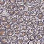 Anti-CEP104 Antibody