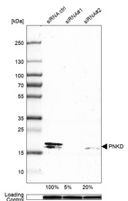 Western blot analysis in MCF-7 cells transfected with control siRNA, target specific siRNA probe #1 and #2, using Anti-PNKD antibody. Remaining relative intensity is presented. Loading control: Anti-GAPDH.