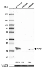 Western blot analysis in MCF-7 cells transfected with control siRNA, target specific siRNA probe #1 and #2, using Anti-PNKD antibody. Remaining relative intensity is presented. Loading control: Anti-GAPDH.