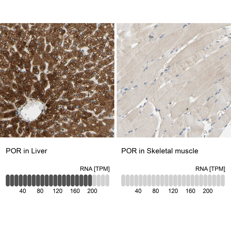 Anti-POR Antibody