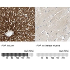 Anti-POR Antibody