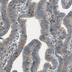 Immunohistochemical staining of human fallopian tube shows moderate cytoplasmic positivity in glandular cells.