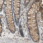 Immunohistochemical staining of human colon shows strong cytoplasmic positivity in glandular cells.
