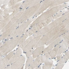 Immunohistochemical staining of human skeletal muscle shows very weak cytoplasmic positivity in myocytes as expected.