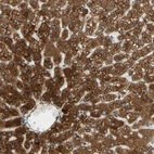 Immunohistochemical staining of human liver shows very strong granular cytoplasmic positivity in hepatocytes.
