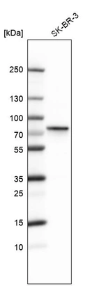Western blot analysis in human cell line SK-BR-3.