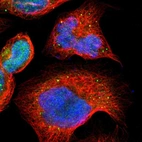 Immunofluorescent staining of human cell line A-431 shows localization to nucleoplasm & vesicles.
