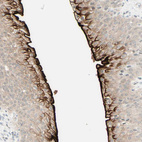 Anti-UPK3B Antibody