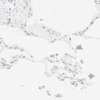 Immunohistochemical staining of human lung shows moderate membranous and cytoplasmic positivity in macrophages.
