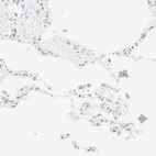 Immunohistochemical staining of human lung shows moderate membranous and cytoplasmic positivity in macrophages.