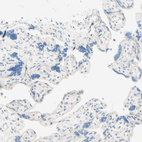 Immunohistochemical staining of human placenta shows no positivity in trophoblastic cells as expected.