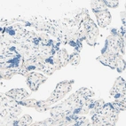 Immunohistochemical staining of human placenta shows no positivity in trophoblastic cells as expected.