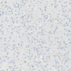 Immunohistochemical staining of human liver shows no positivity in hepatocytes as expected.