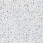 Anti-UPK3B Antibody