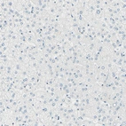 Immunohistochemical staining of human liver shows no positivity in hepatocytes as expected.