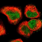 Immunofluorescent staining of human cell line A-431 shows localization to nucleus & vesicles.
