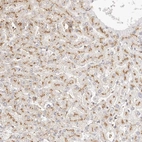 Anti-CNMD Antibody