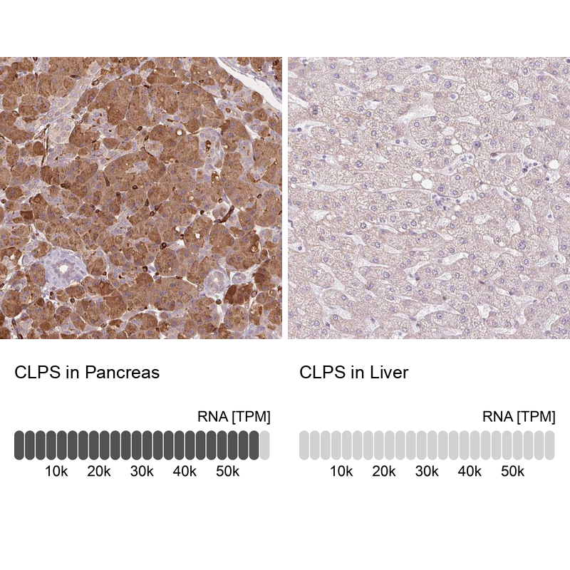 Anti-CLPS Antibody