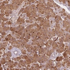Immunohistochemical staining of human pancreas shows strong cytoplasmic positivity in exocrine glandular cells.