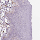 Immunohistochemical staining of human skin shows no cytoplasmic positivity in squamous epithelial cells as expected.