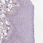 Immunohistochemical staining of human skin shows no cytoplasmic positivity in squamous epithelial cells as expected.