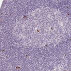 Immunohistochemical staining of human lymph node shows no cytoplasmic positivity in non-germinal center cells as expected.