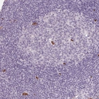 Immunohistochemical staining of human lymph node shows no cytoplasmic positivity in non-germinal center cells as expected.