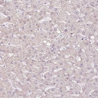 Immunohistochemical staining of human liver shows no cytoplasmic positivity in hepatocytes as expected.