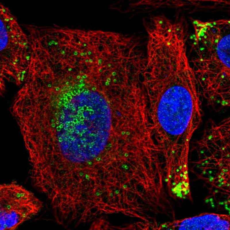 Anti-HILPDA Antibody