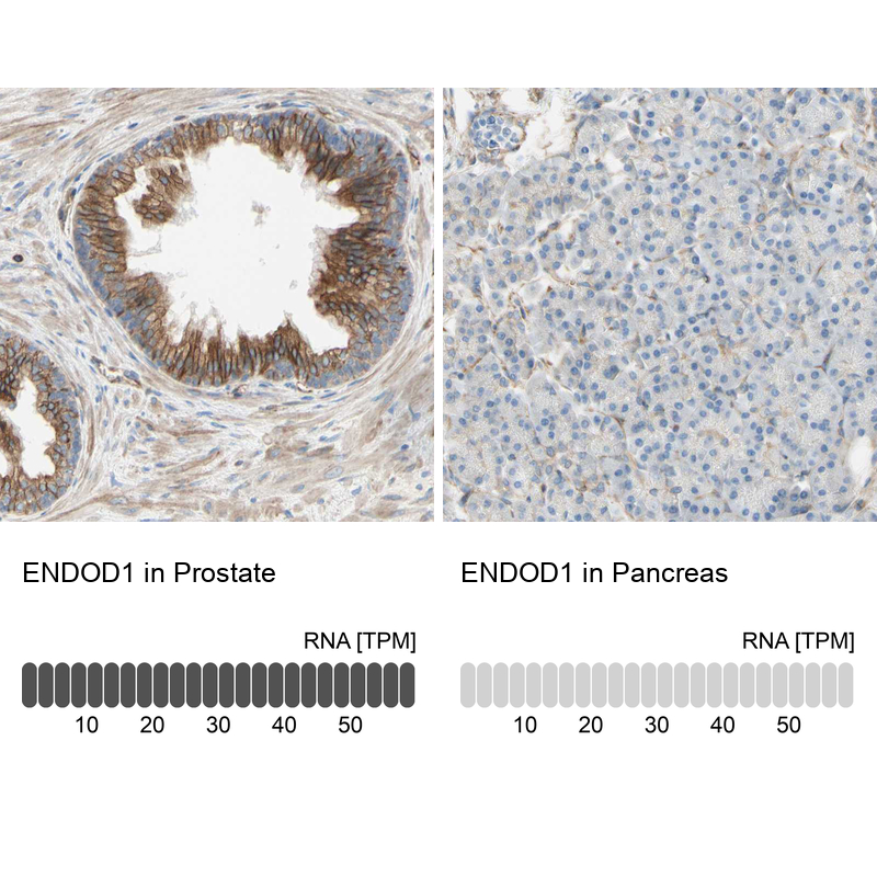 Anti-ENDOD1 Antibody