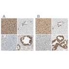Immunohistochemical staining of human cerebral cortex, liver, pancreas and prostate using Anti-ENDOD1 antibody HPA010517 (A) shows similar protein distribution across tissues to independent antibody HPA008932 (B).