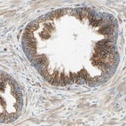 Immunohistochemical staining of human prostate shows moderate cytoplasmic positivity in glandular cells.