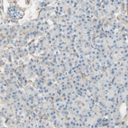 Immunohistochemical staining of human pancreas shows no positivity in exocrine glandular cells as expected.